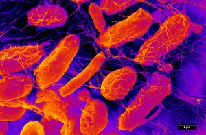 In this scanning electron microscope image, the bacteria (Acetobacter xylinum) is producing cellulose nanofibers, which are incredibly strong for how light they are. Engineers use the nanofibers to create materials that have a wide range of uses, from strong composites to tissue engineering. Image by Thomas Ellingham, UW-Madison mechanical engineering graduate student. 