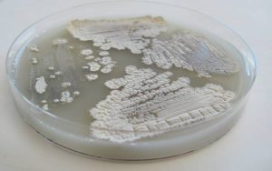 celluloseStreptomyces